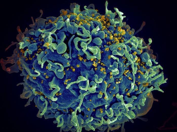 Top 10 Most Important Facts About Hiv Everyone Should Know
