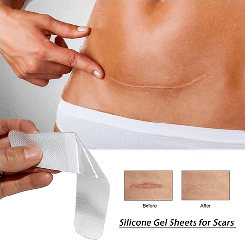 Top 10 Best Expert-Approved Ways To Fade All Types Of Scars 630