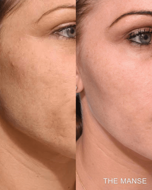 Top 10 Best Expert-Approved Ways To Fade All Types Of Scars 614