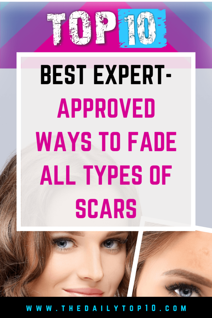Top 10 Best Expert-Approved Ways To Fade All Types Of Scars