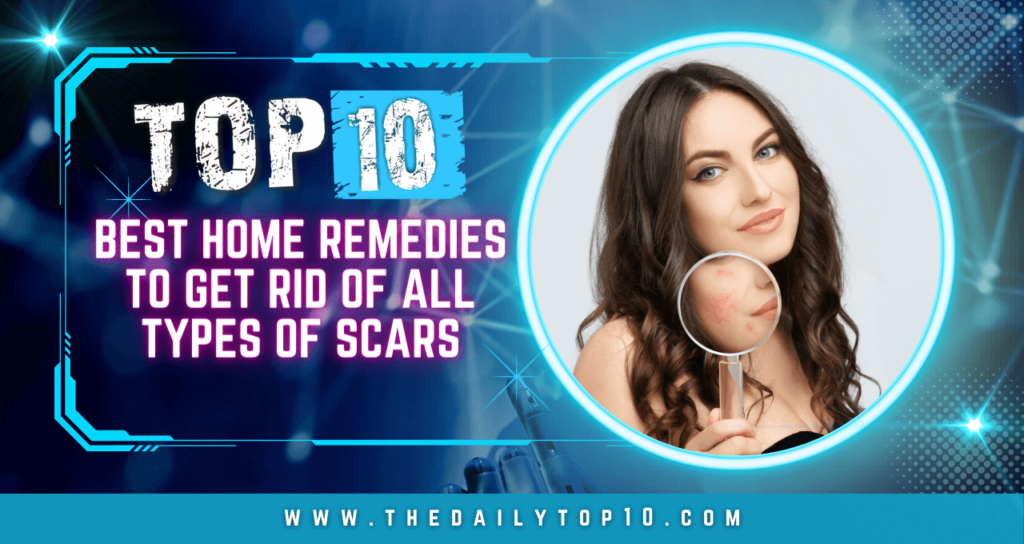 Top 10 Best Home Remedies To Get Rid of All Types of Scars